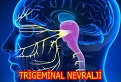 trigeminal
